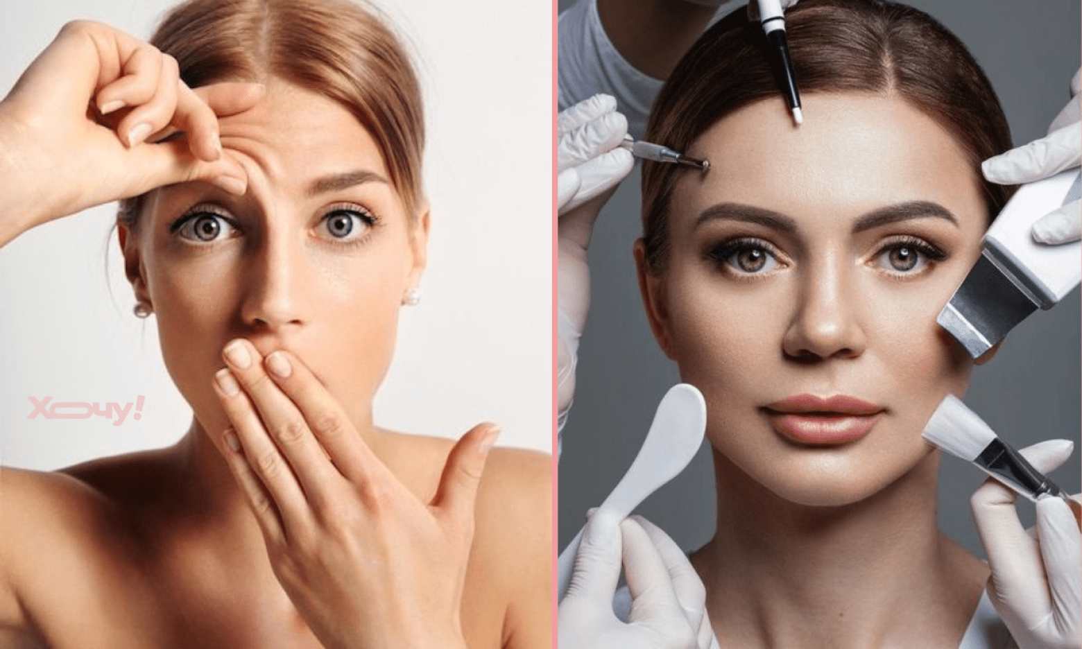 Турбують зморшки на лобі? Ось як зменшити їх кількість у домашніх умовах