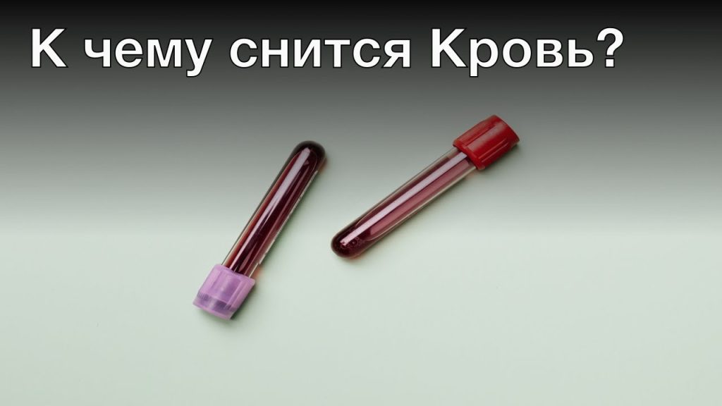 К Чему Снится Кровь: Толкования и Значения Снов